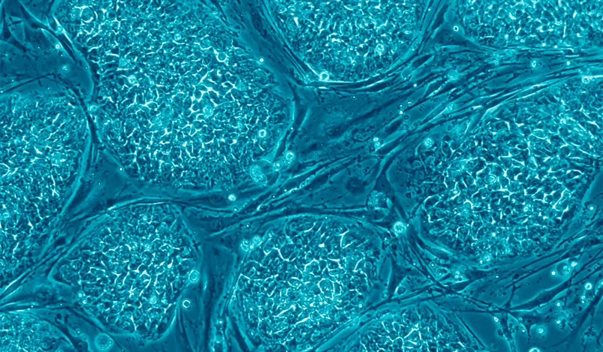 Une Nouvelle Étude sur les Cellules Souches : Vers des Vaccins Personnalisés contre le Cancer
