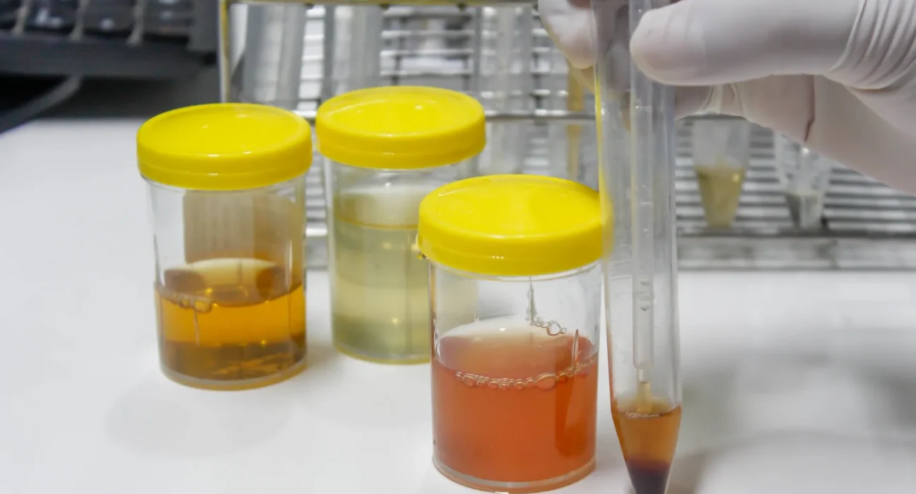 Utilisation de l'urine concentrée pour l'agriculture durable