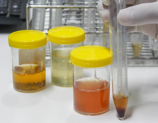 Utilisation de l'urine concentrée pour l'agriculture durable