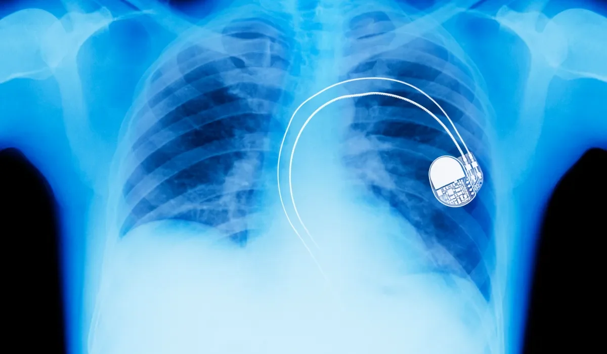 Batterie Organiques Flexibles : Une Révolution pour les Implants Médicaux