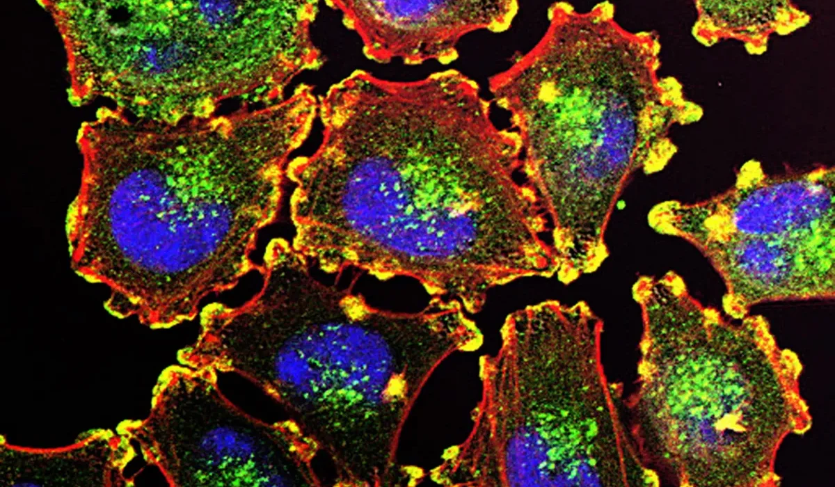 Des Chercheurs Découvrent une Protéine 'Exécuteur' Inductrice de l'Auto-Détruction des Cellules Cancéreuses Sans Endommager les Cellules Saines