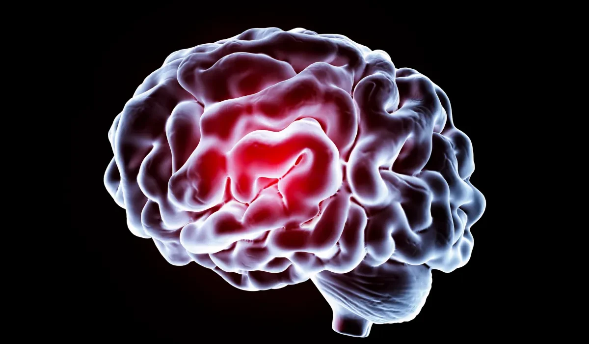 Des Scientifiques Améliorent Pour la Première Fois la Mémoire Humaine Grâce à un Implant Cérébral