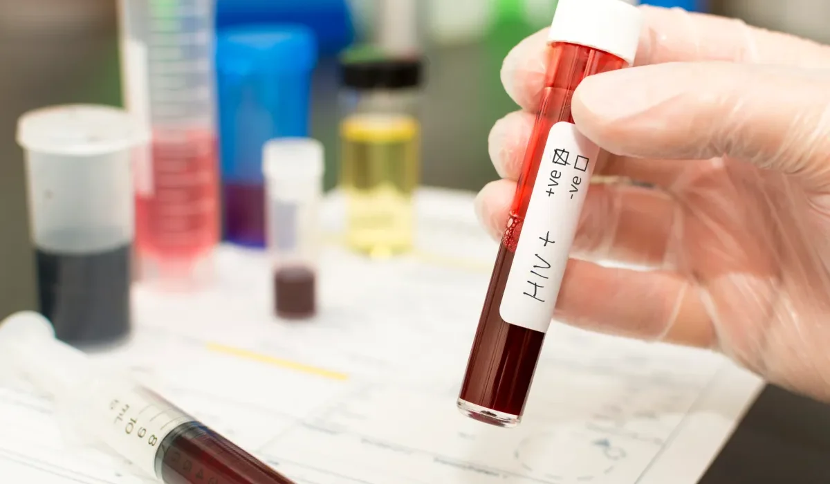 Des Scientifiques Éliminent l'ADN du VIH par Chirurgie sur des Animaux Vivants