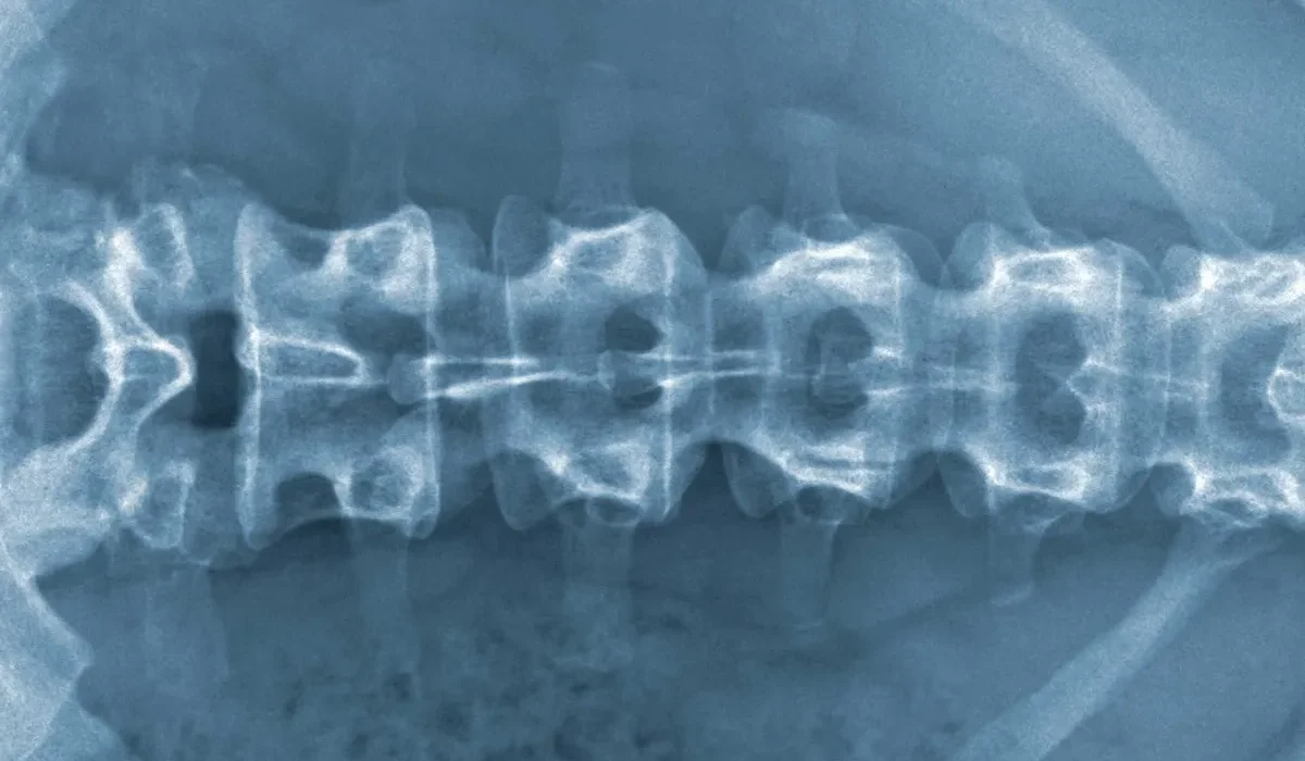 Des avancées scientifiques sur la réparation cellulaire des blessures spinales.