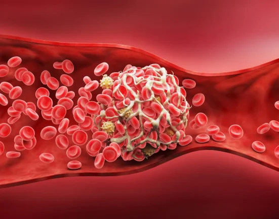Des caillots sanguins conçus en laboratoire : une solution potentiellement salvatrice pour arrêter les hémorragies rapides