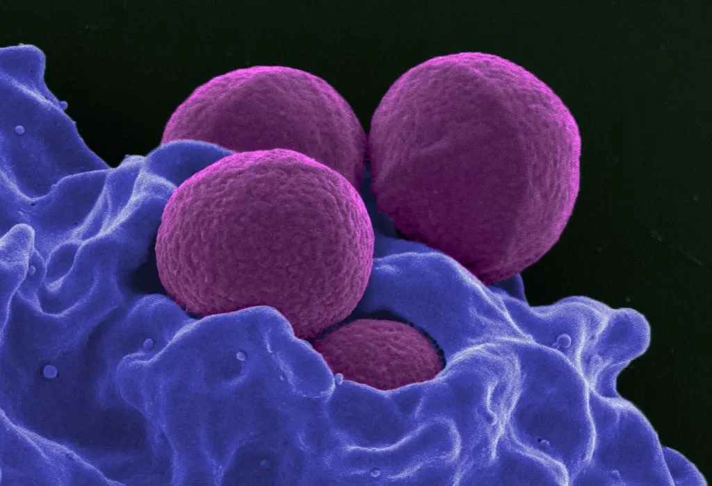 Des chercheurs identifient une voie prometteuse pour renverser la résistance aux antibiotiques dans les superbugs.