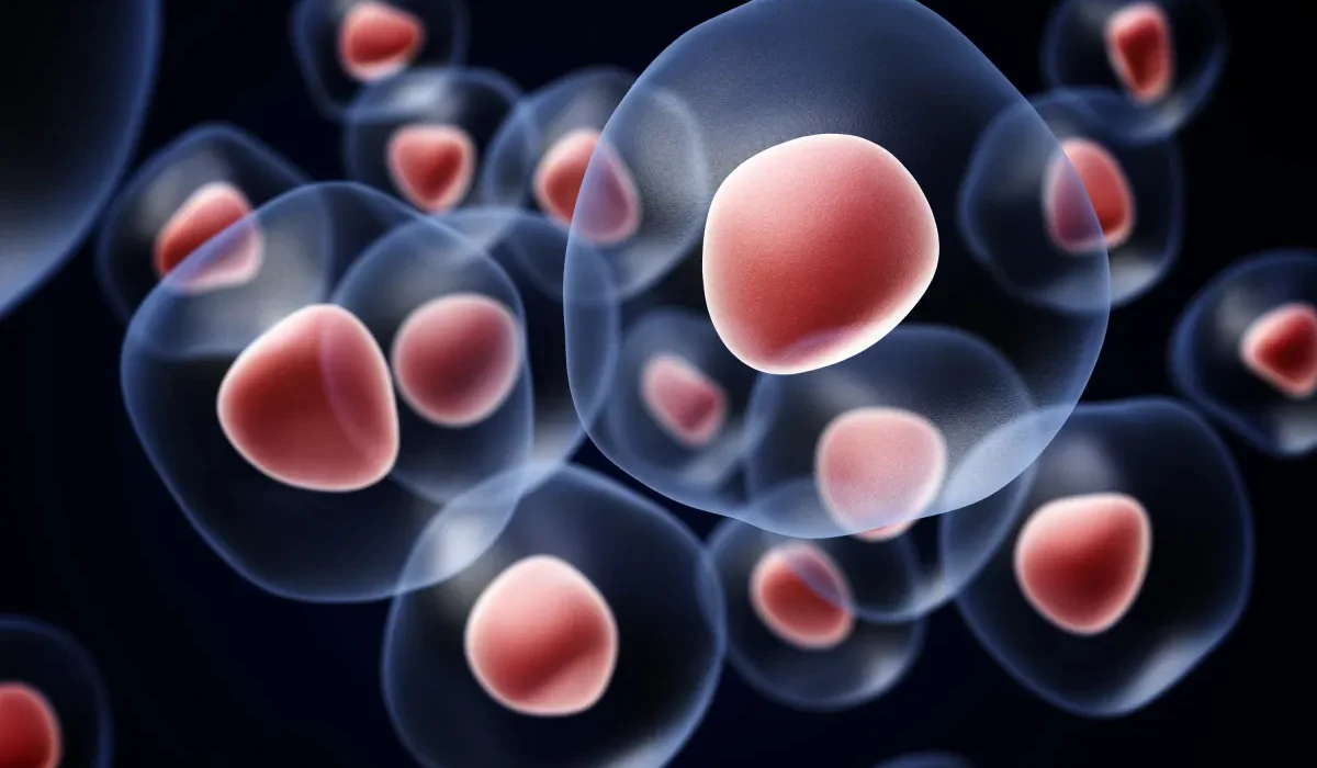Des scientifiques franchissent une étape décisive vers la guérison du diabète grâce à une première implantation de cellules souches.