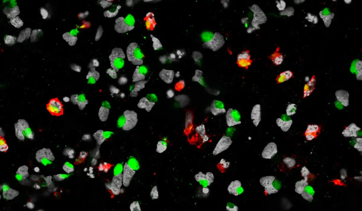 La Recherche Révèle que le Virus Zika Tue les Cellules Souches du Cancer Cérébral