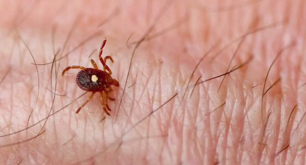 L'augmentation inquiétante de l'allergie potentiellement mortelle à la viande rouge causée par les morsures de tique sur Long Island.
