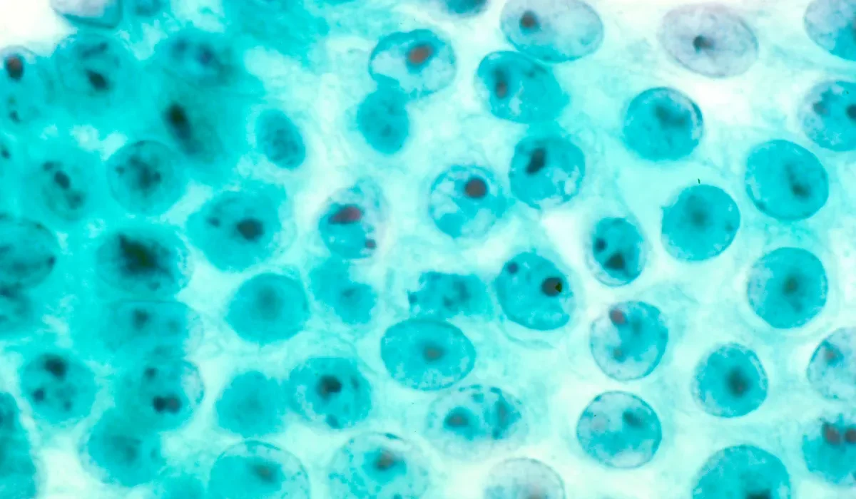 Les Mini Organes : Une Révolution dans le Traitement des Maladies, de la Fibrose Kystique au Cancer