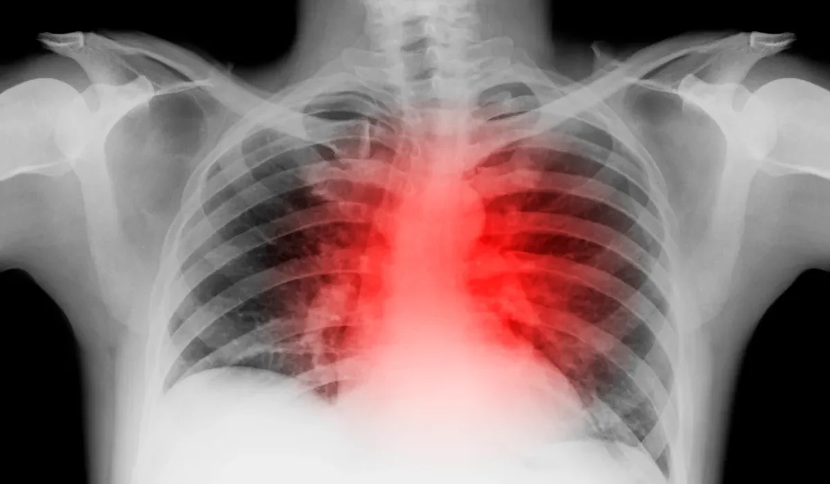 Les scientifiques parviennent à inverser l'insuffisance cardiaque avancée chez des souris.