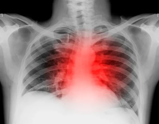 Les scientifiques parviennent à inverser l'insuffisance cardiaque avancée chez des souris.