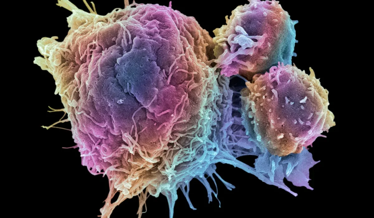 Microsoft Utilise l'IA et l'Apprentissage Automatique pour Développer un Remède Contre le Cancer.