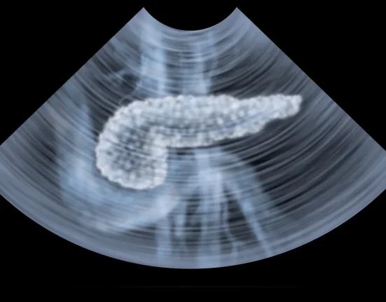 Nouvelle méthode révolutionnaire pour détecter le cancer du pancréas plus tôt, doublant ainsi les taux de survie.