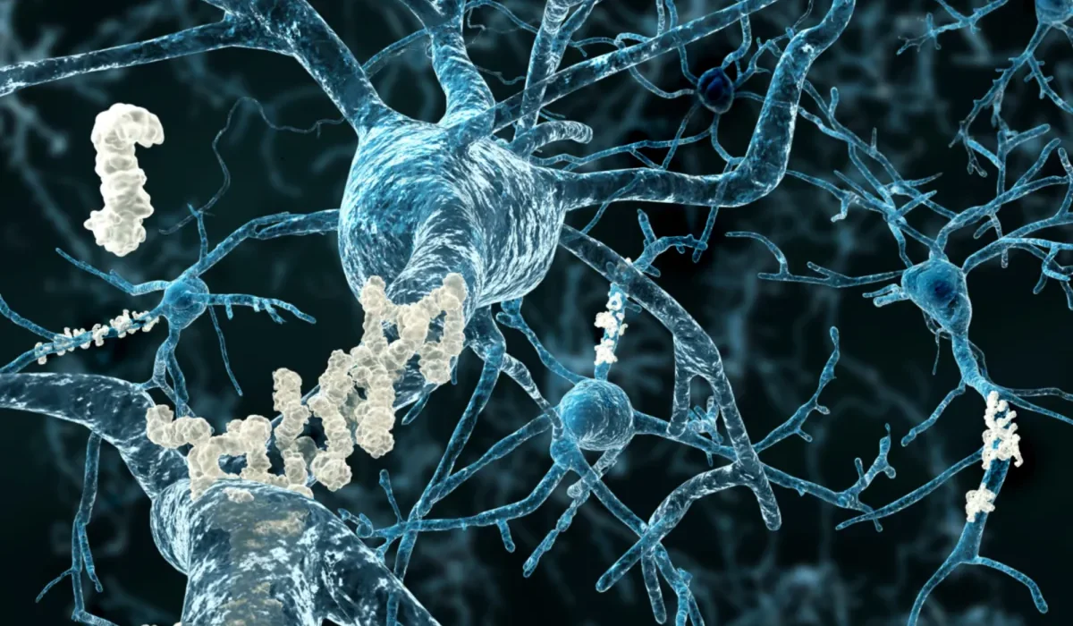 Nouvelles Découvertes : L'Alzheimer pourait Commencer en Dehors du Cerveau.