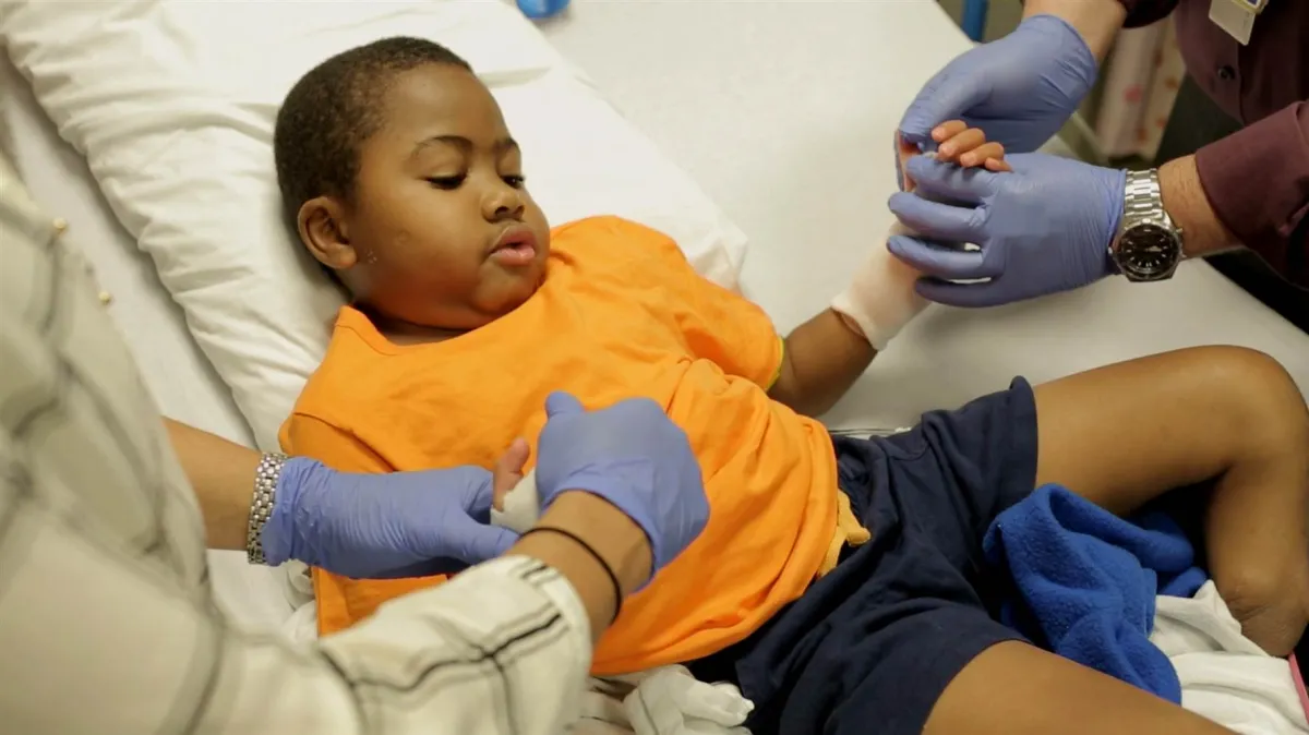 Succès historique : Première greffe bilatérale des mains chez un jeune patient.