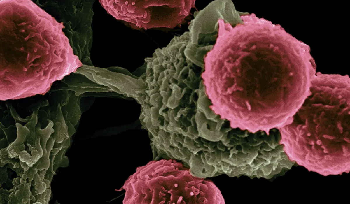 Une Approche Révolutionnaire : Un Traitement Génétiquement Modifie Vos Propres Cellules Approuvé par un Comité de la FDA.