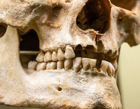 Une Dent de Néandertal Âgée de 59,000 Ans Révèle des Preuves de Chirurgie