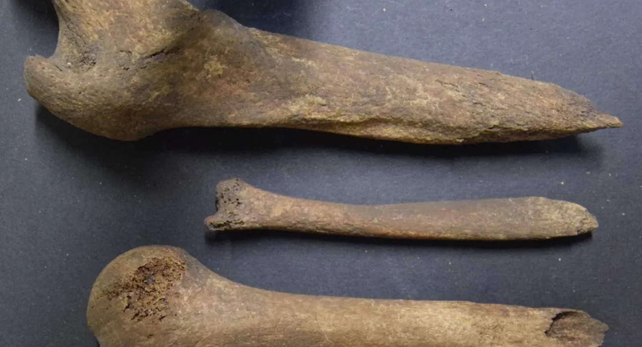 À l'intérieur du crâne d'une femme de l'âge du fer en Écosse : des chercheurs découvrent des traces d'ablation cérébrale.