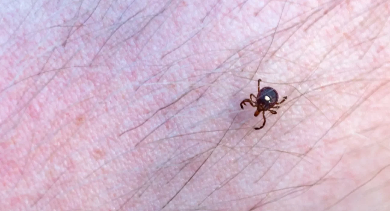 Alerte des autorités sanitaires : un tick à surveiller en Rhode Island lié à une allergie durable à la viande rouge.