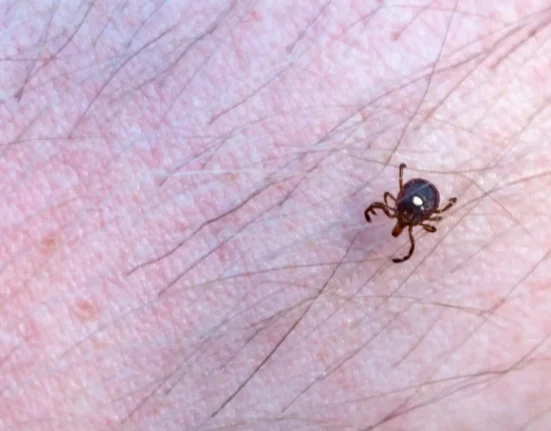 Alerte des autorités sanitaires : un tick à surveiller en Rhode Island lié à une allergie durable à la viande rouge.