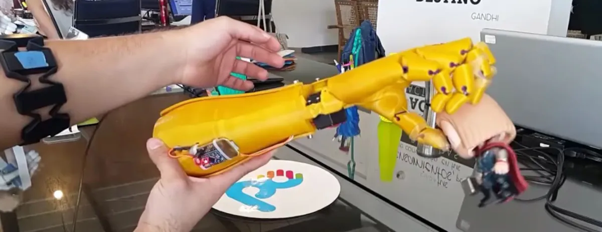 Bienvenue dans un Univers de Prothèses Imprimées en 3D.