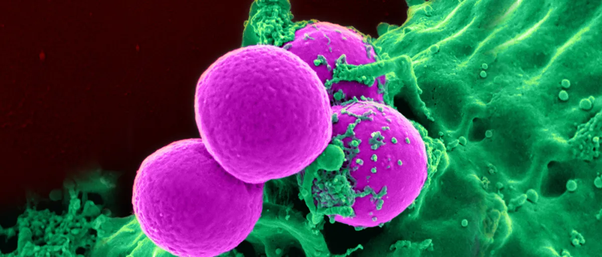 Des Scientifiques Découvrent Comment Utiliser la Nature pour Éliminer les Superbactéries.