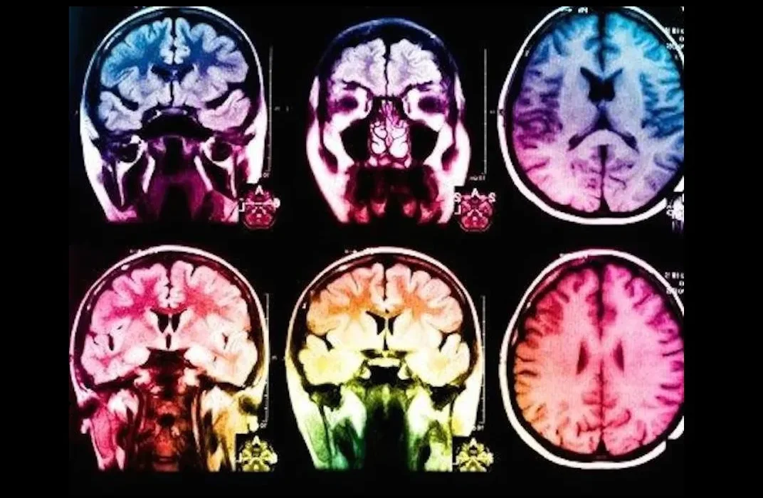 Des avancées biotechnologiques pourraient ramener à la vie des personnes en état de mort cérébrale.