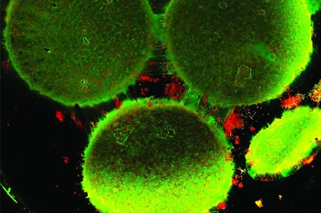 Des chercheurs développent un nouveau "Cerveau sur puce" révolutionnaire.
