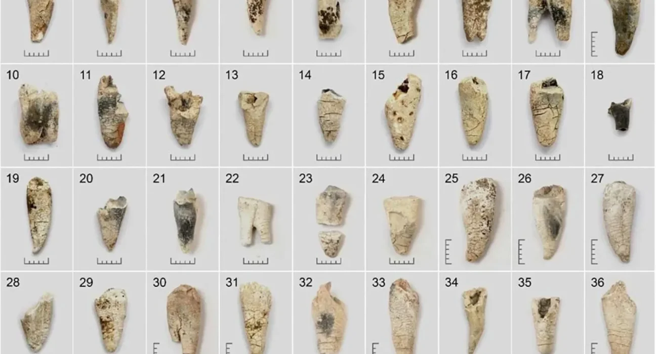 Des dents incinérées révèlent leurs secrets : des urnes vieilles de 3 000 ans defient les archéologues.