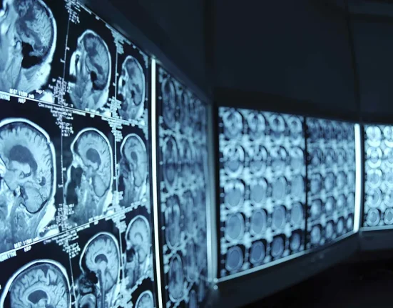 Enlitic lève 10 millions de dollars pour soutenir sa technologie de deep learning médical.