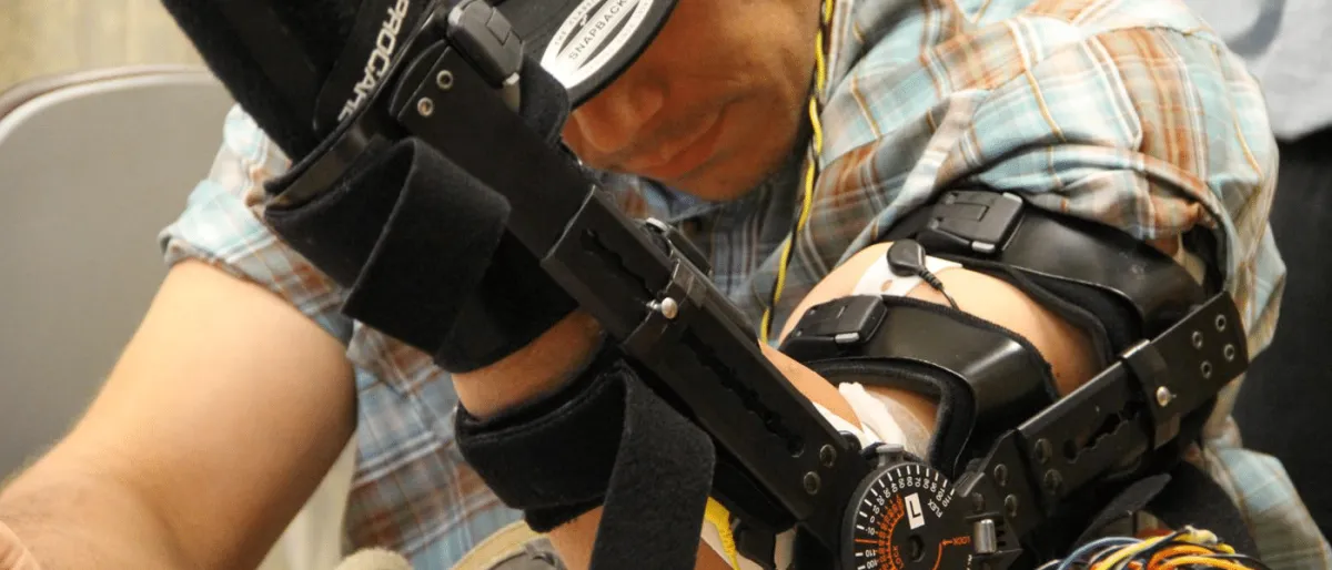 Implant Spinal Innovant : Amélioration de 300 % de la Mobilité et de la Préhension chez les Quadriplégiques