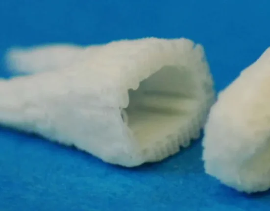 Implants Dentaires à Cellules Souches : Faites Pousser Vos Nouvelles Dents Directement Dans Votre Bouche
