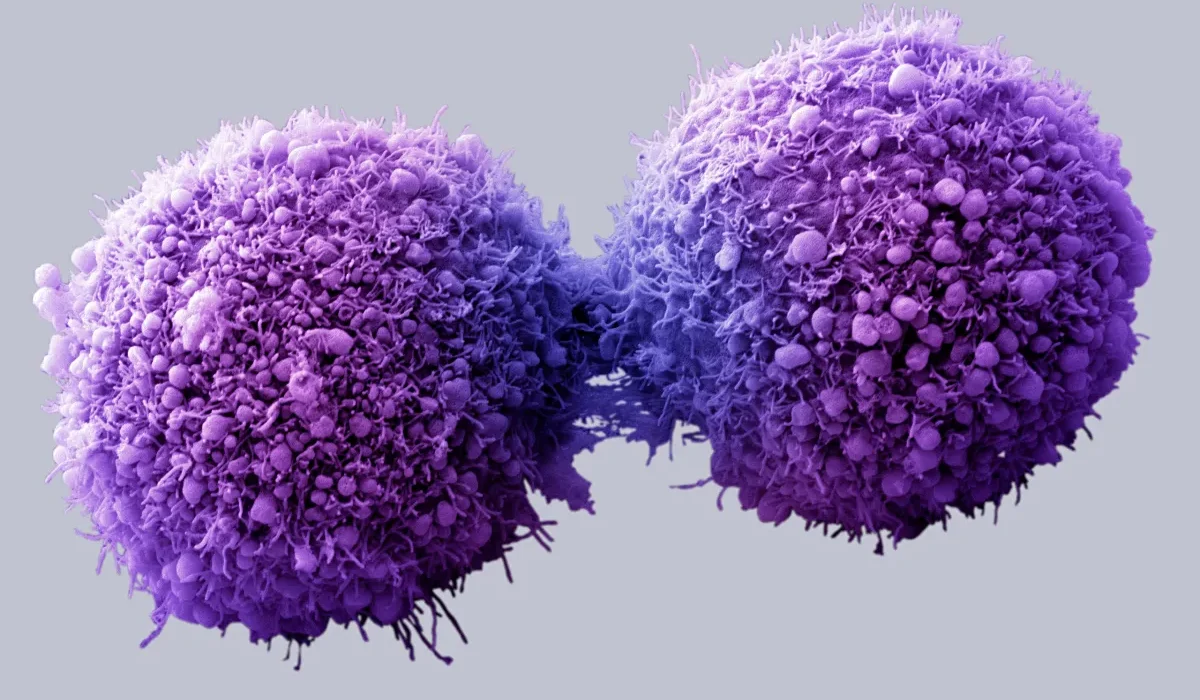 Impression 3D de Tumeurs Cérébrales : Une Révolution dans la Lutte Contre le Cancer