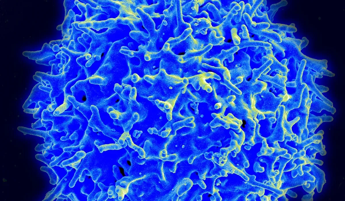 La thérapie par cellules T : des résultats "extraordinaires" pour les patients atteints de cancer lors des essais cliniques préliminaires.