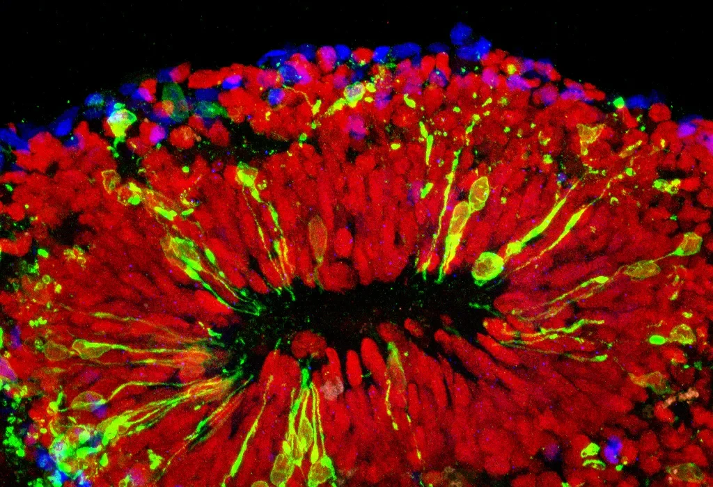 « Les Minibrains : Une Révolution Potentielle pour la Médecine »