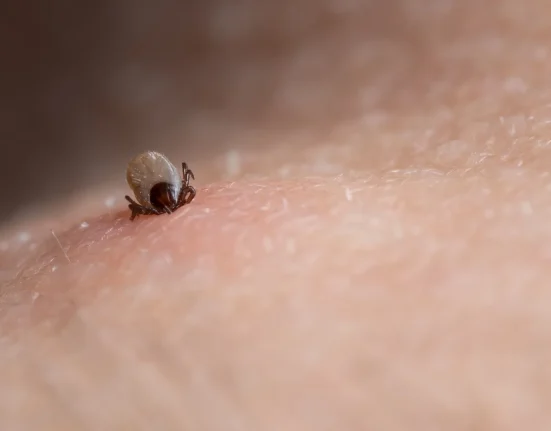 Les morsures de tiques aux États-Unis peuvent transmettre le virus Powassan en 15 minutes, et les cas augmentent.