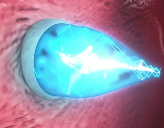 Réparation non invasive des anomalies cardiaques : une avancée révolutionnaire.