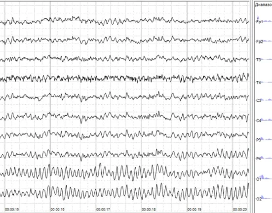 Substituer Votre Mot de Passe par une Analyse Cérébrale