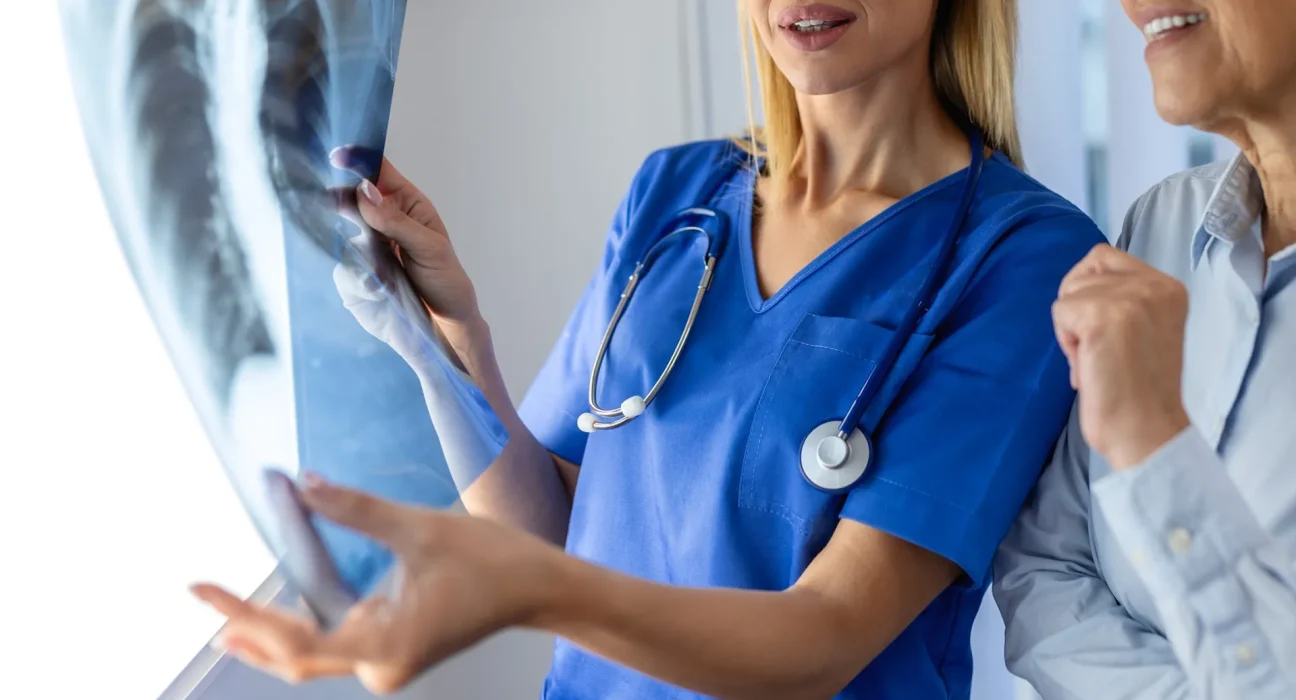 Un nouveau traitement du cancer du poumon réduit les tumeurs chez 43 % des patients malgré l'échec de la chimiothérapie et de l'immunothérapie