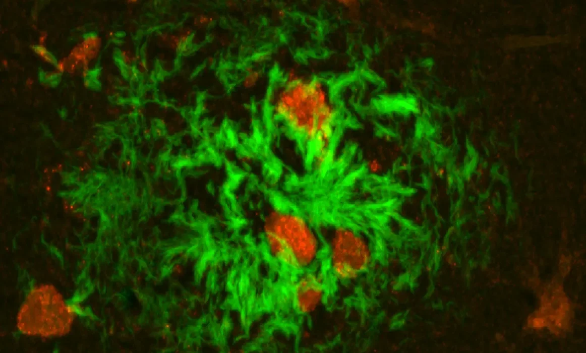 Un traitement révolutionnaire contre Alzheimer restaure complètement la mémoire chez 75 % des souris.