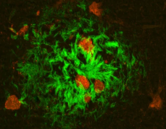 Un traitement révolutionnaire contre Alzheimer restaure complètement la mémoire chez 75 % des souris.