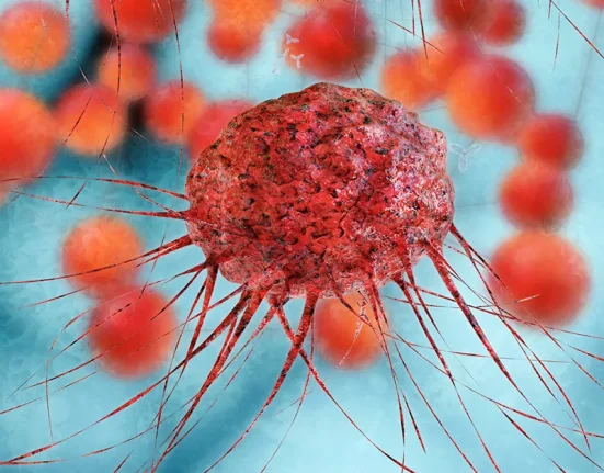 Une Étude Révèle que les Cellules Immunitaires d'Autrui Peuvent Lutter Contre le Cancer d'une Personne.