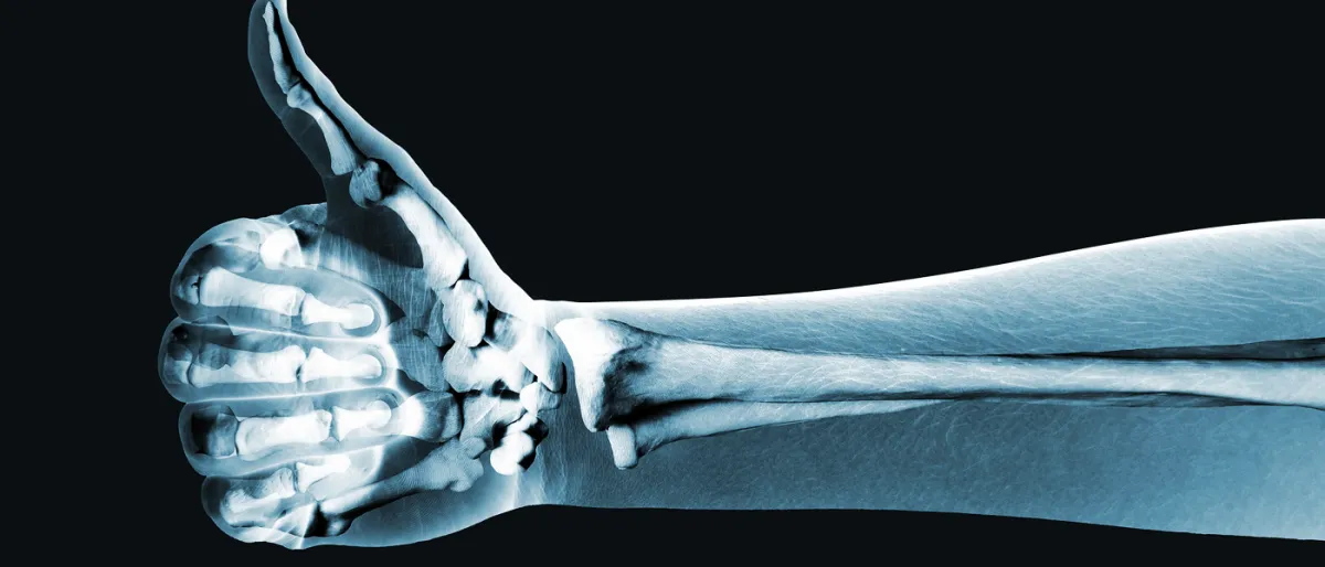 Une Nouvelle Entreprise Se Lance Dans La Culture D'Os Humains À Partir De Cellules Adipeuses.