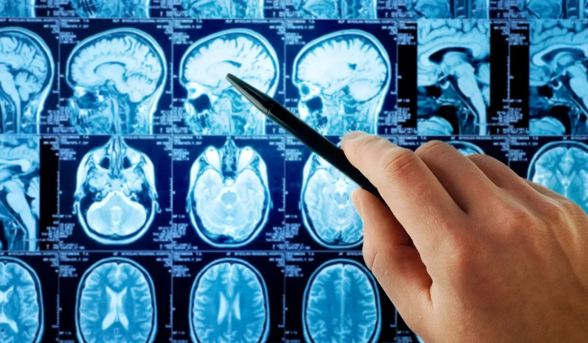 Une étude révèle qu'un algorithme d'apprentissage profond détecte 100% des cancers, contre 93% pour les radiologues humains