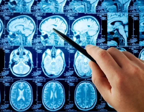 Une étude révèle qu'un algorithme d'apprentissage profond détecte 100% des cancers, contre 93% pour les radiologues humains