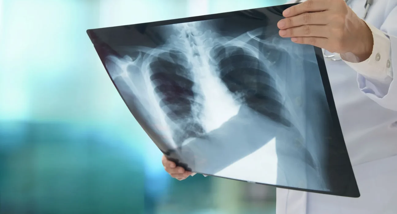 New York écarte le lien entre les décharges et le cancer du poumon, mais les habitants voisins restent inquiets.
