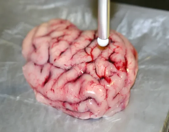 « Scalpel Intelligent : Détection des Tumeurs en Moins d'une Seconde »
