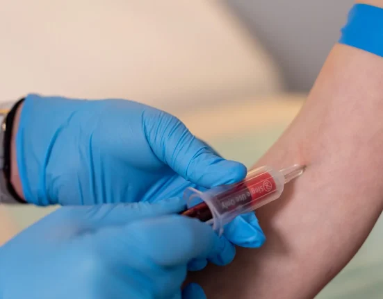 Une étude révèle un lien entre les crises cardiaques et l'augmentation des microplastiques dans le sang.