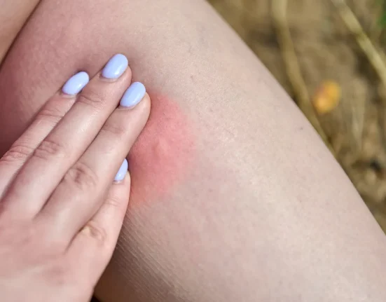 Kansas en alerte : l'ensemble de l'État à haut risque de virus du Nil occidental cette saison des moustiques